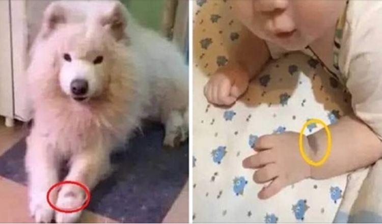 Žena ujišťuje, že její dítě je reinkarnací jejího psa kvůli mateřskému znaménku